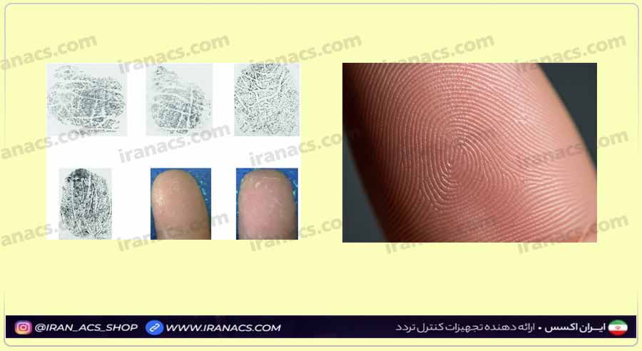 عوامل پزشکی از بین برنده اثر انگشت