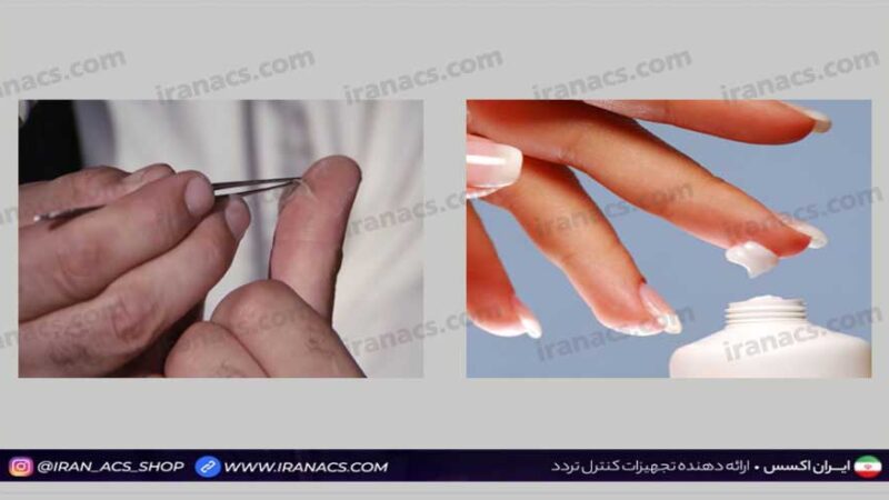 راهکارهای از بین بردن اثر انگشت